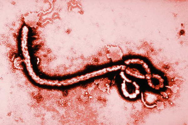 Минздрав: Эбола не пройдёт!
