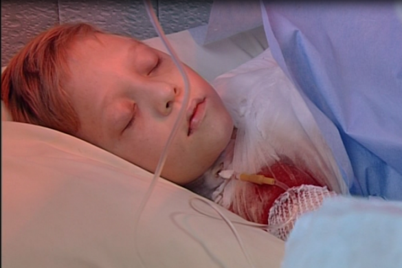 Жертва веерных отключений: 10-летний мальчик попал в реанимацию с ожогами