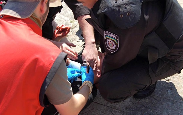Нардеп: Раненный в ходе гей-парада милиционер — в реанимации на аппарате искусственного дыхания