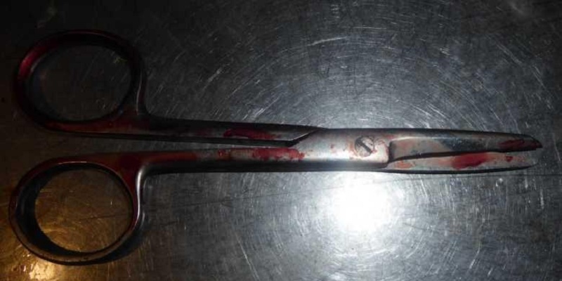 В Киеве мужчина проткнул ножницами шею товарищу на рыбалке