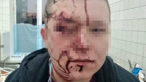 В киевской больнице пациент разбил стулом голову врачу