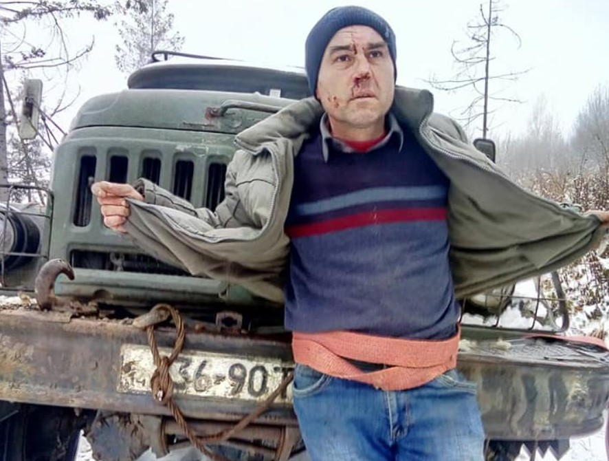 На Львівщині журналіста побили, прив’язали до лісовоза і тягли по землі
