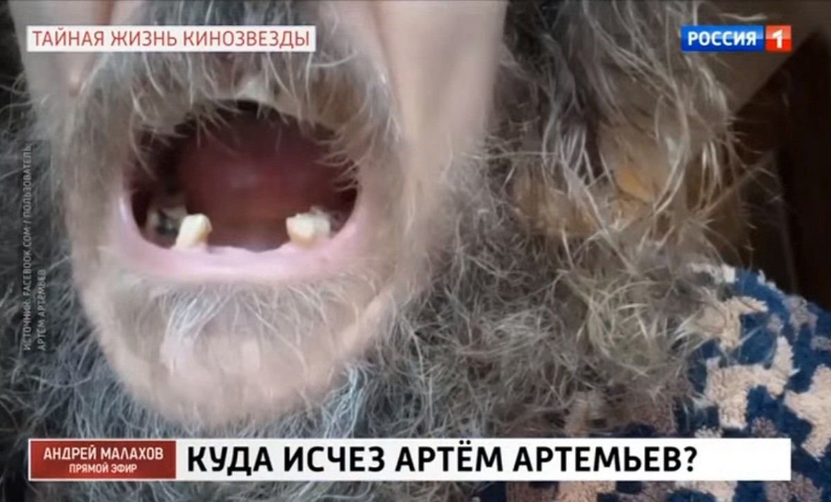 «Выпали все зубы и волосы»: звезда сериала «Татьянин день» Артем Артемьев заявил, что его отравили