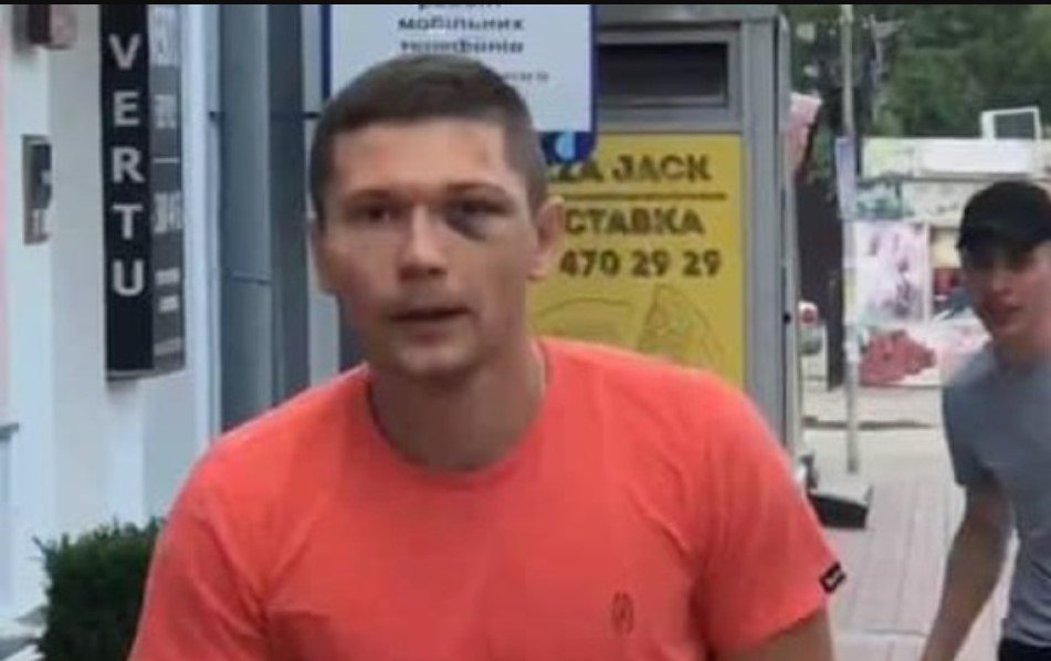 Танцора Дорофеевой избил сотрудник УГО: его отстранили от службы