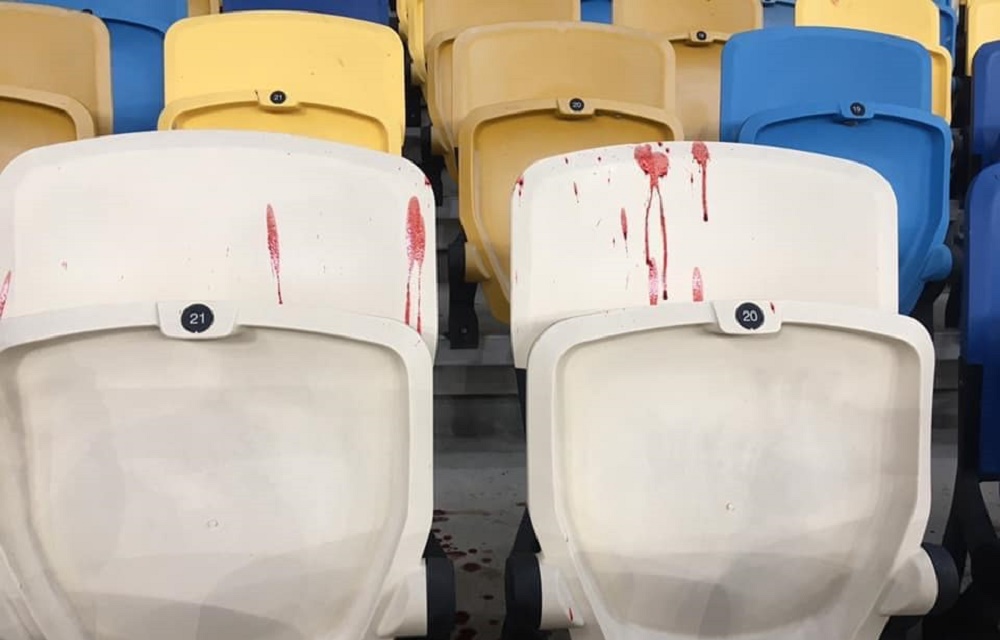 Ультрас «Динамо Киев» на стадионе избили болельщиков, которые пришли с детьми (видео)