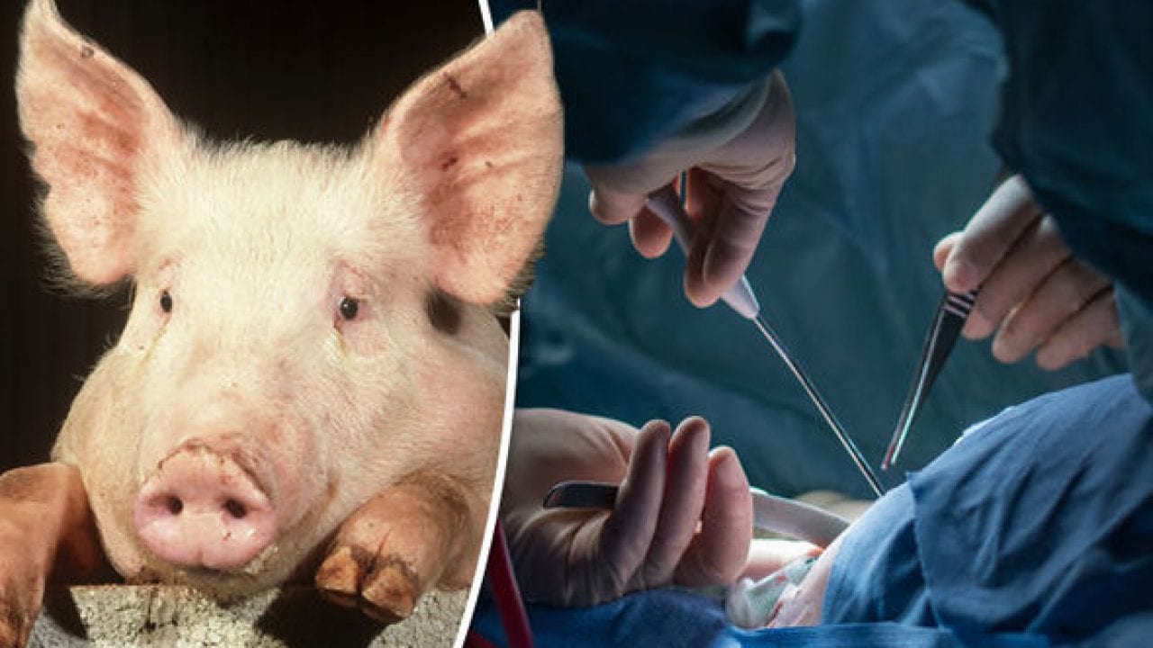 Американские хирурги впервые успешно пересадили человеку почку свиньи